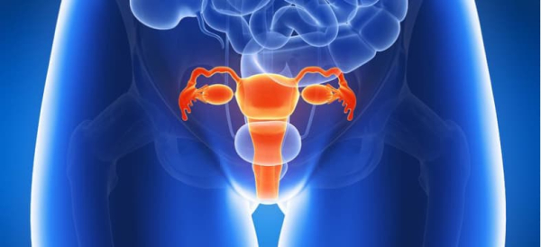 Ovarian cancer