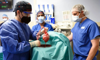Članovi hirurškog tima pokazuju svinjsko srce spremno za transplantaciju na pacijenta Dejvida Beneta u Baltimoru, 7. januara 2022. Foto: Medicinski fakultet Univerziteta Merilend